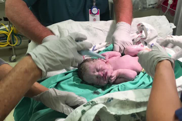 Le bébé de williams qui ne savaient pas que Brooke était enceinte